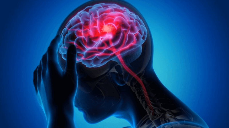 Neurology